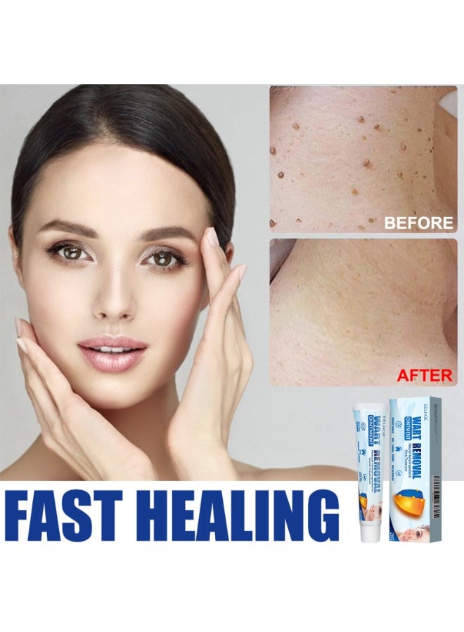 إيلهو مرهم لإزالة الثآليل، مكونات طبيعية لعلاج آمن لثآليل الجسم وحب الشباب والشامات وتقليل الندبات، يزيل الثآليل والشامات وينعم البشرة. - Image 4